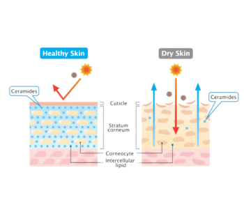 ceramide np